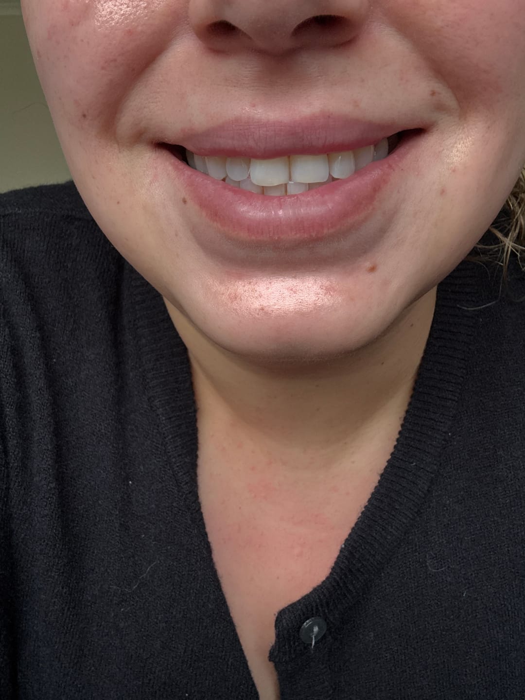 Customer photo review of Kit Smile+