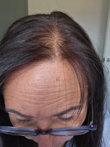 Customer photo review of Order Shipping Protection & Insurance