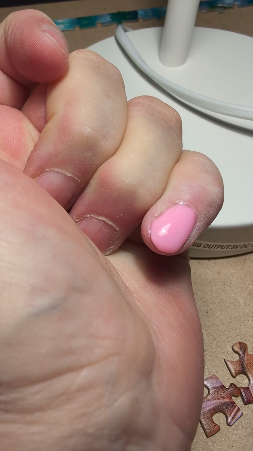 Customer photo review of Premium 4-In-1 Buffervijl