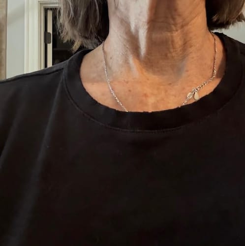 Customer photo review of Dermave™ Eye & Neck Care Set