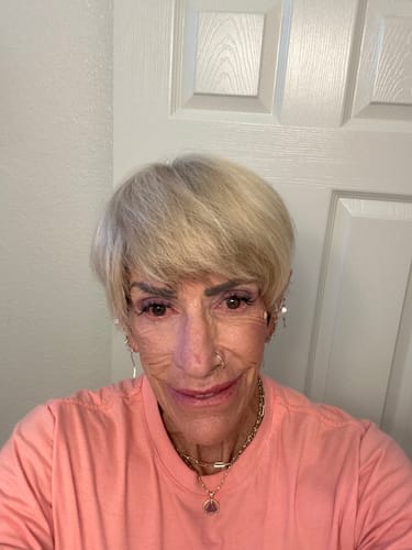 Customer photo review of Grass Fed Tallow & Honey Balm