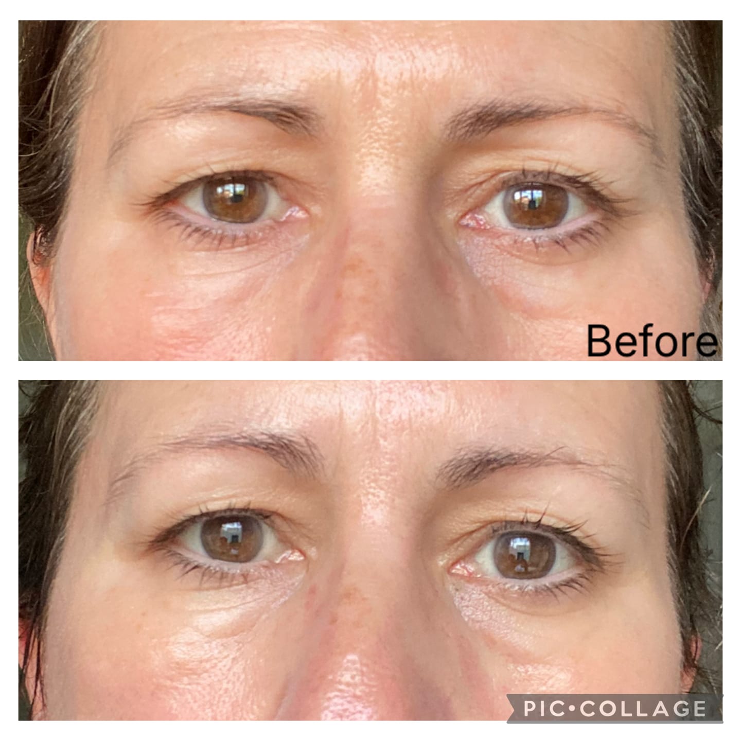 Customer photo review of Global Eye & Lip Care