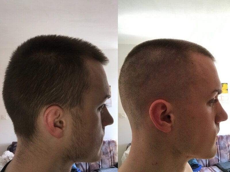 Customer photo review of BladeOne- Profesionalna mašinica za šišanje