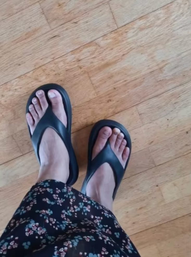 Customer photo review of The Snuggi Arch Support Thongs