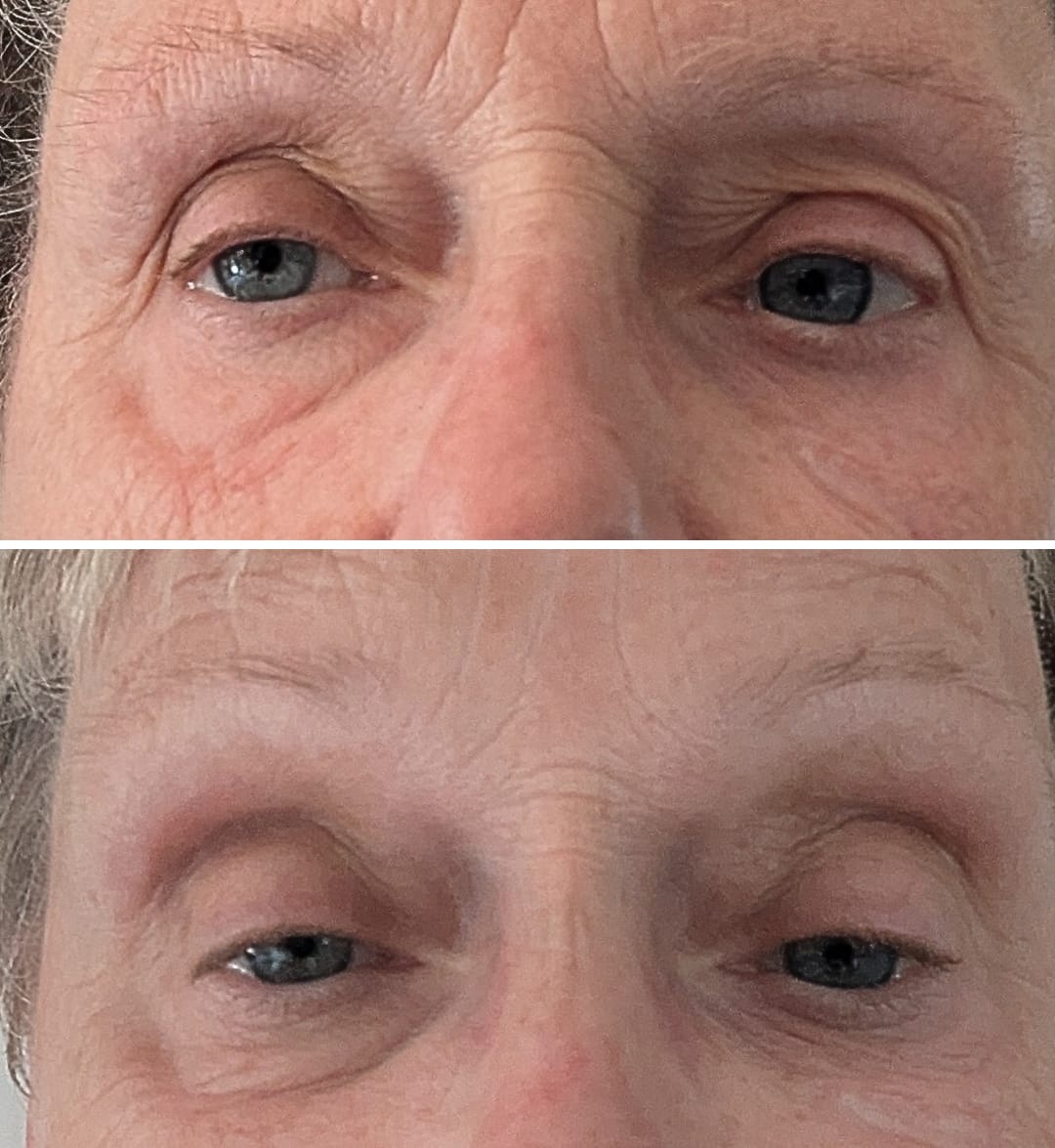 Customer photo review of Global Eye & Lip Care