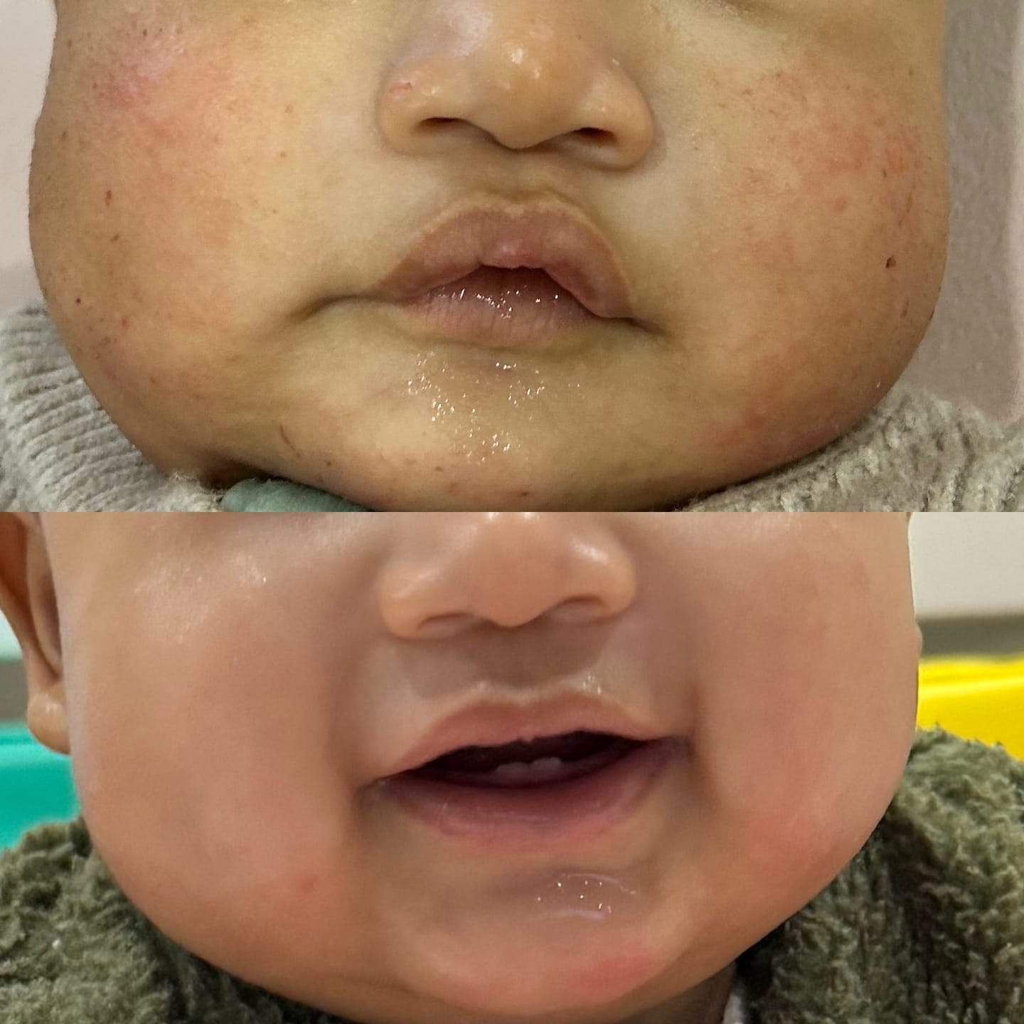 Customer photo review of Manuka Moisturising Baby Butter