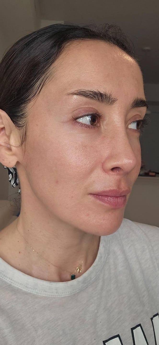 Customer photo review of BLACK RICE probiotics barrier essence
