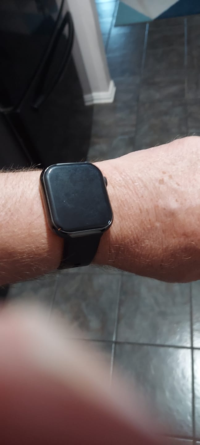 Customer photo review of Bearscome Blood Sugar Blood Pressure Blood oxygen Sleep Monitoring Waterproof Smartwatch