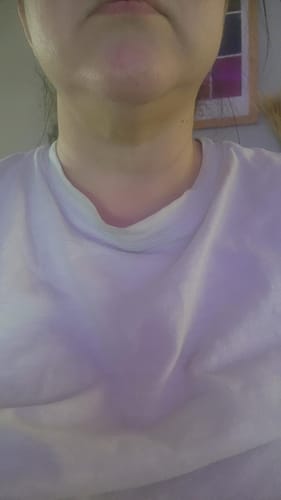 Customer photo review of Dermave™ Eye & Neck Care Set