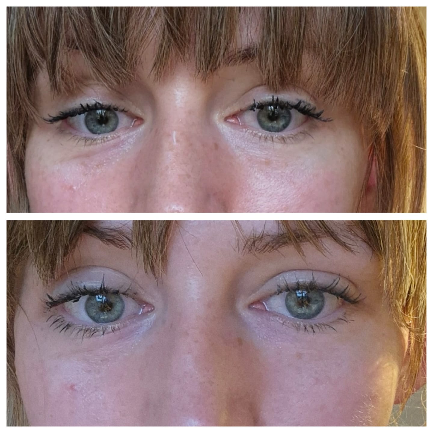 Customer photo review of Global Eye & Lip Care