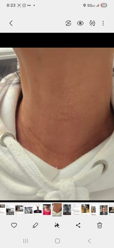 Customer photo review of Dermave™ Eye & Neck Care Set