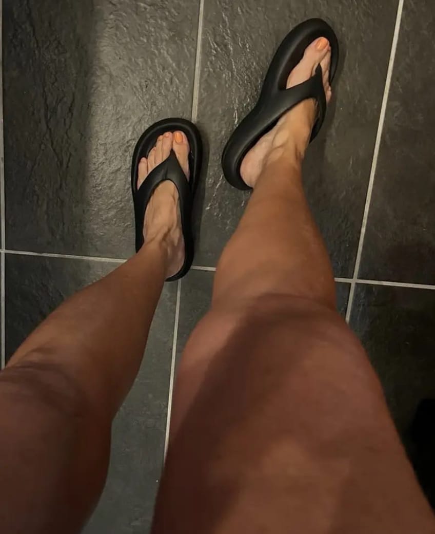 Customer photo review of The Snuggi Arch Support Thongs
