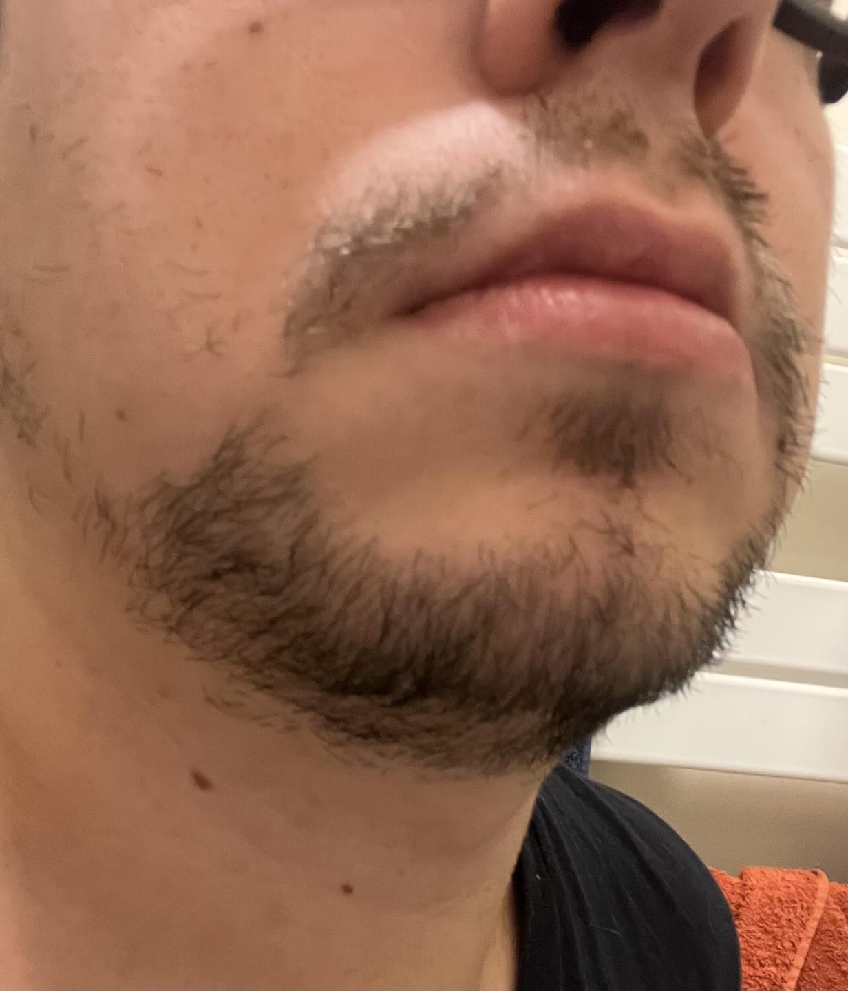 Customer photo review of Sérum Thorin | Huile de croissance de Barbe