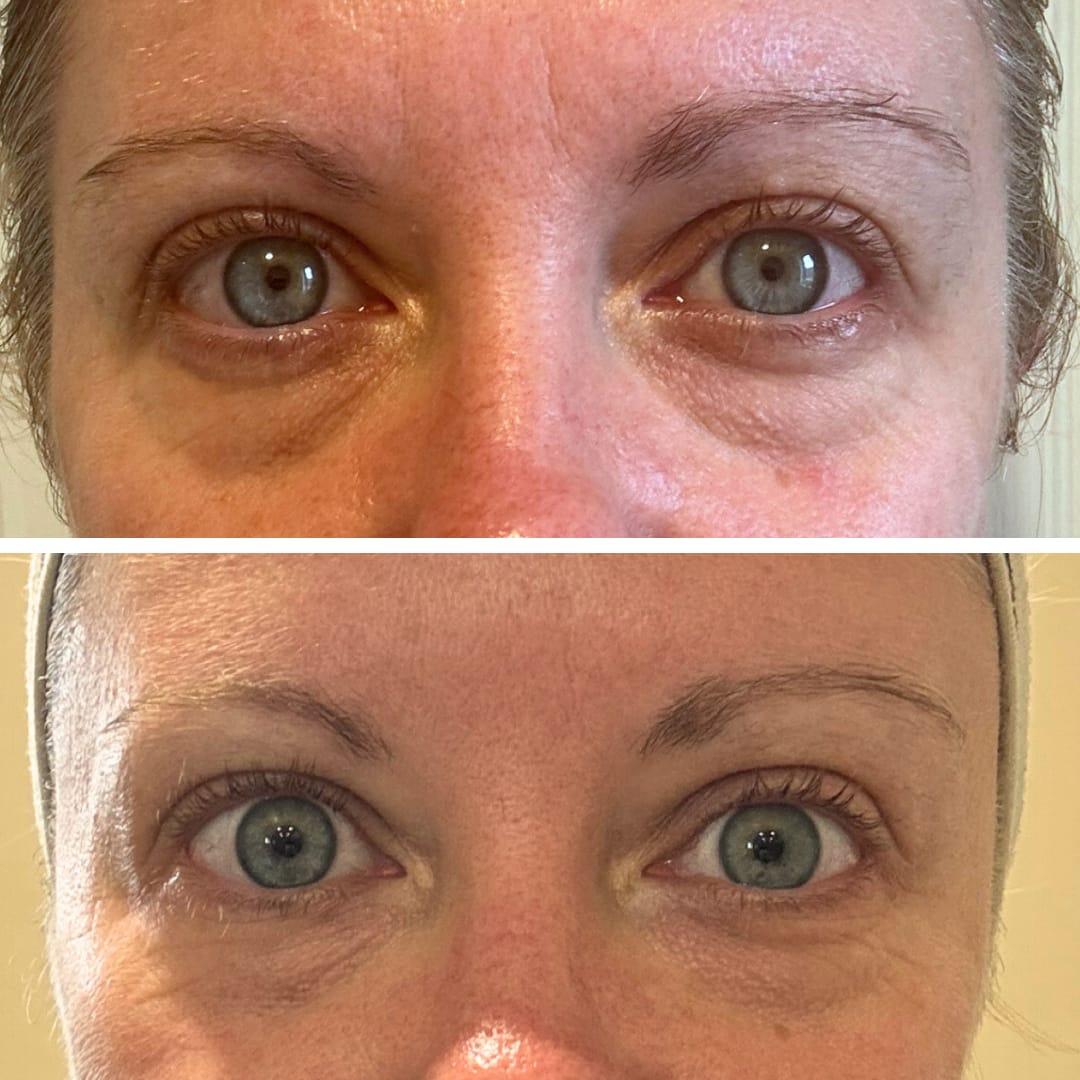Customer photo review of Global Eye & Lip Care
