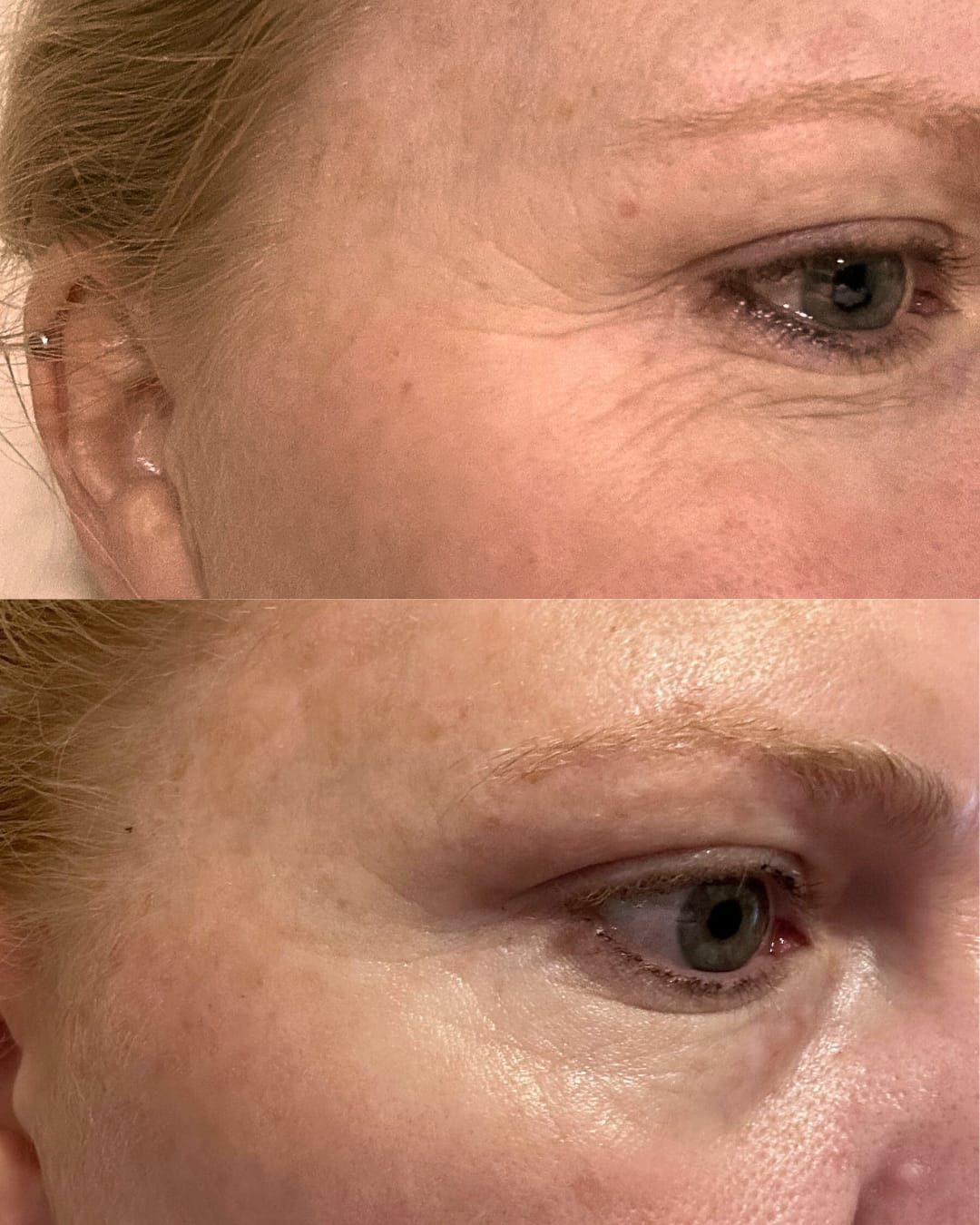 Customer photo review of Global Eye & Lip Care