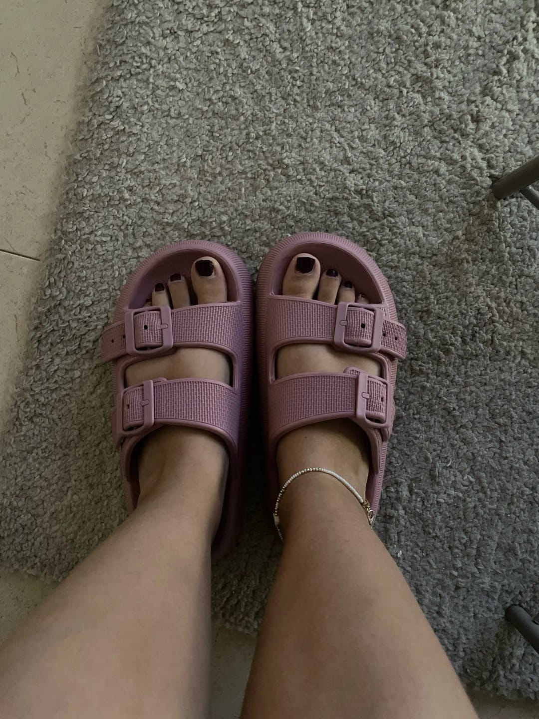 Customer photo review of The Snuggi Arch Support Thongs