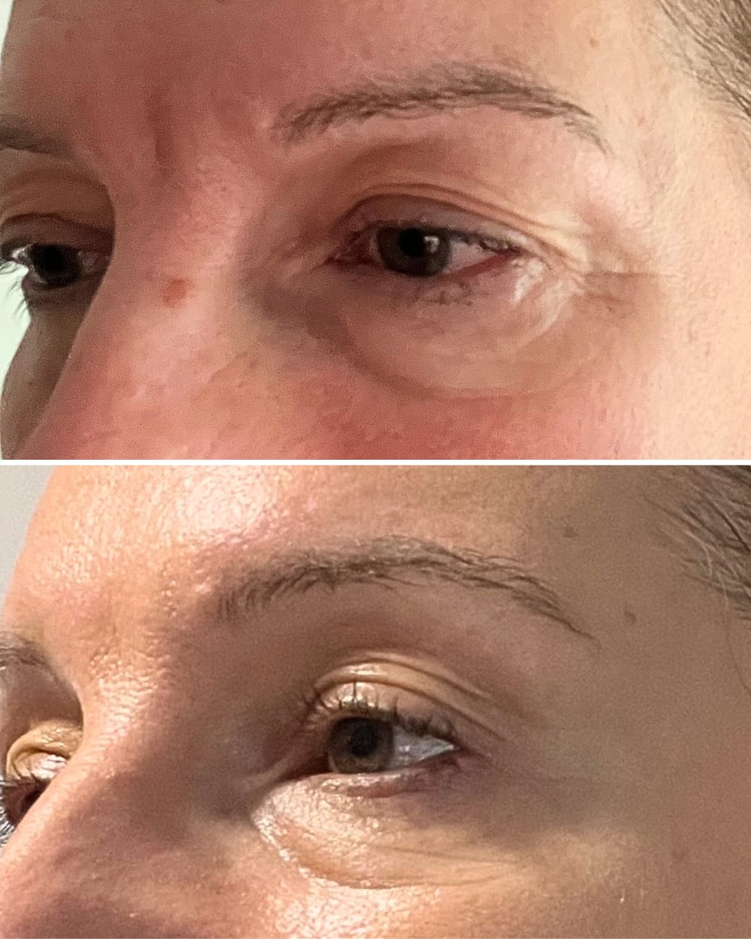 Customer photo review of Global Eye & Lip Care