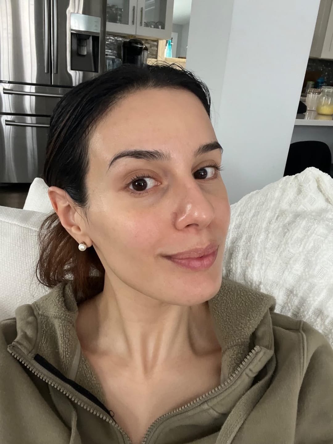 Customer photo review of CENTELLA phyto & 5 peptide concentrate cream