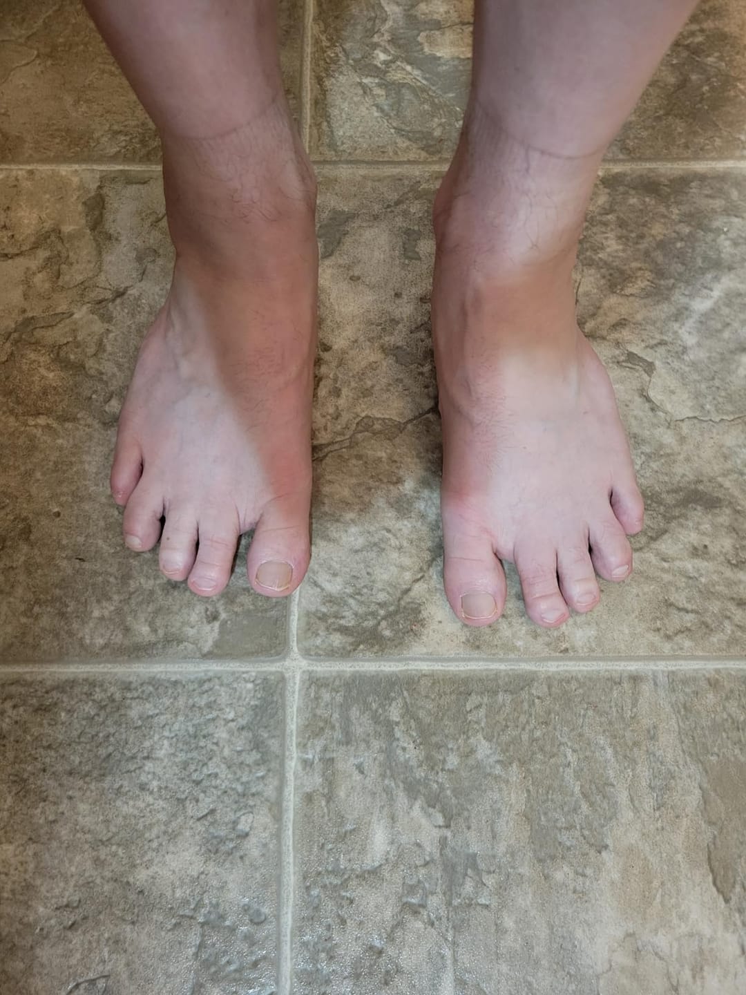 Customer photo review of Flow - Wide Toe Box & Zero Drop Shoes (Unisex)