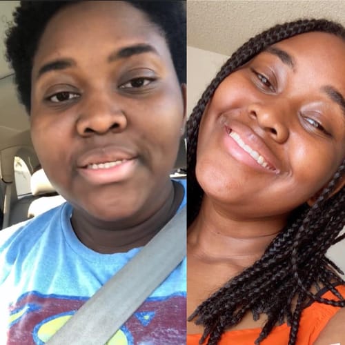 Customer photo review of Dermave™ Eye & Neck Care Set