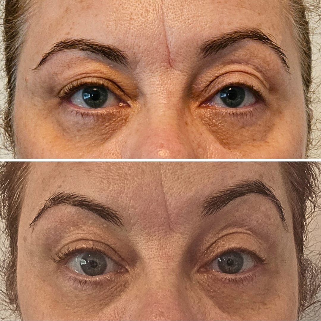 Customer photo review of Global Eye & Lip Care