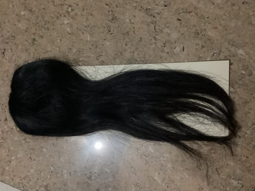 Customer photo review of INVISIBLE COVER-UP PATCH