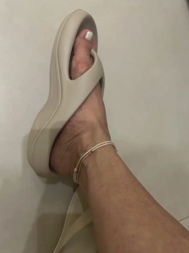 Customer photo review of The Snuggi Arch Support Thongs