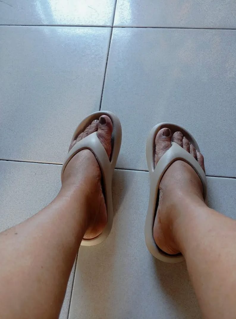 Customer photo review of The Snuggi Arch Support Thongs