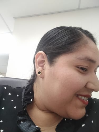 Customer photo review of Aretes Spot