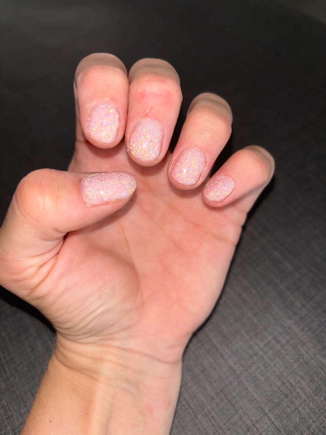 Customer photo review of Premium 4-In-1 Buffervijl