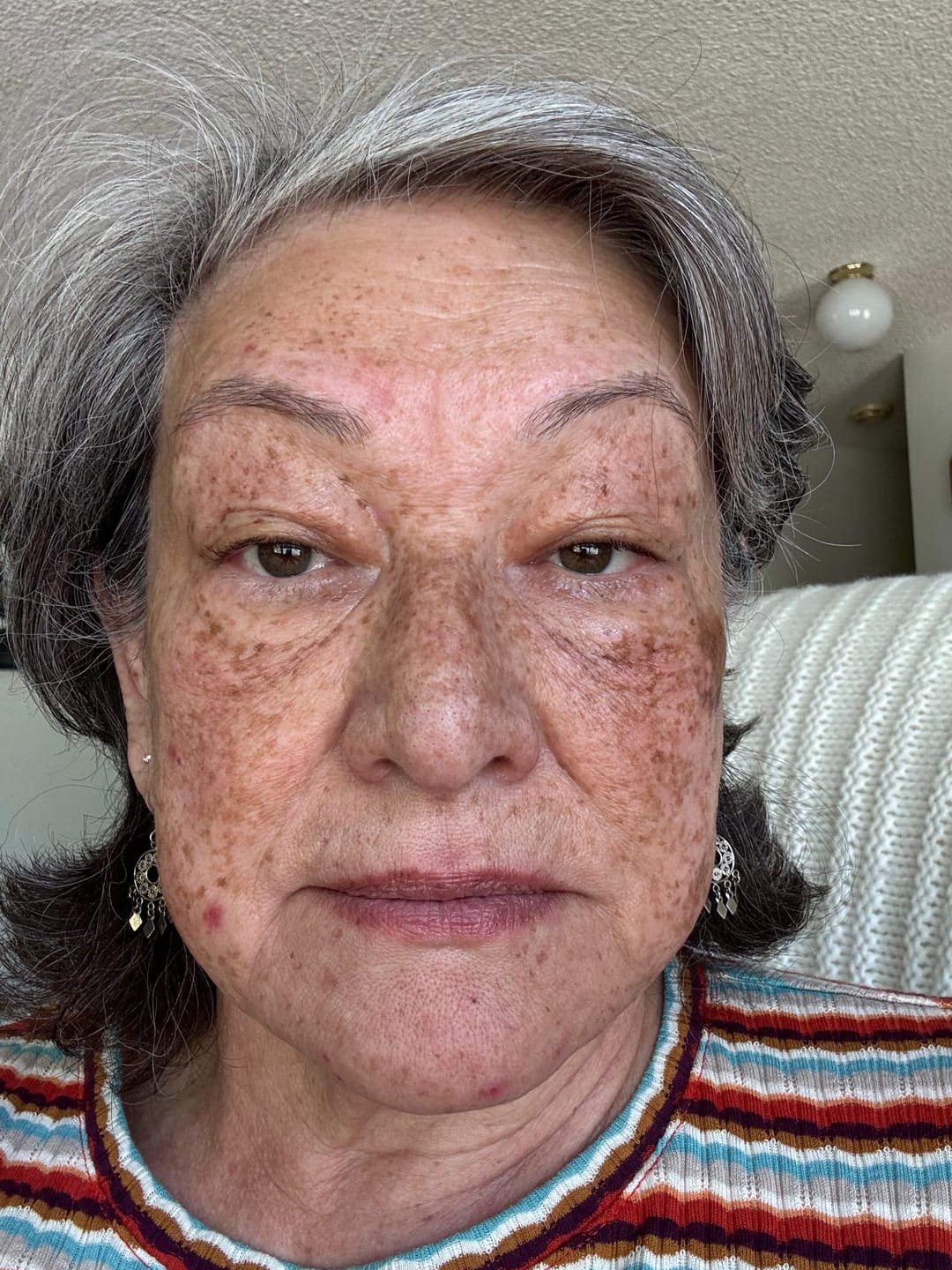 Customer photo review of The Complete System for Mature Women’s Skin