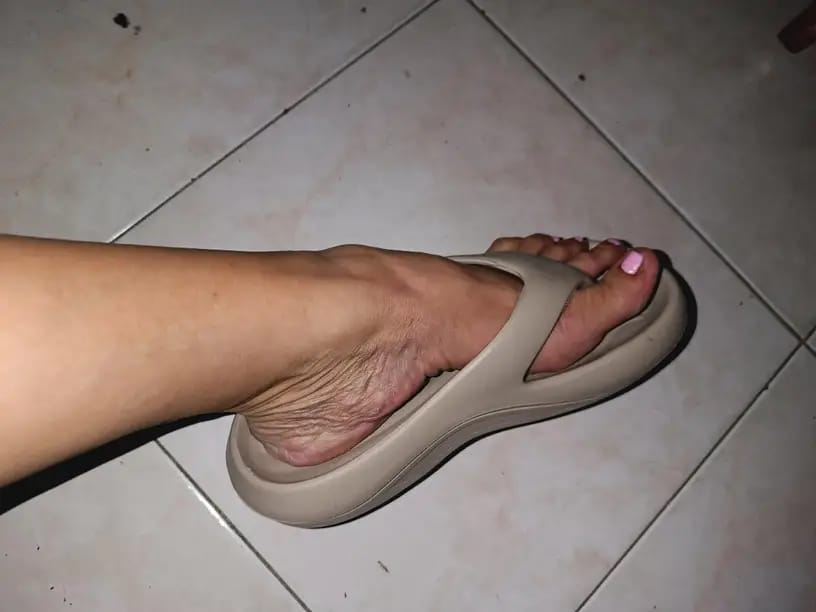 Customer photo review of The Snuggi Arch Support Thongs