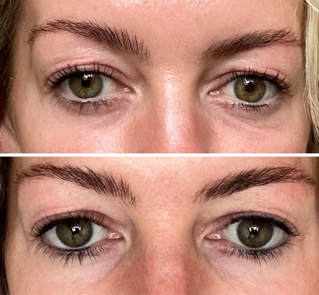 Customer photo review of Global Eye & Lip Care