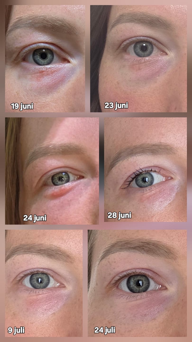 Customer photo review of Eye & Lip cream