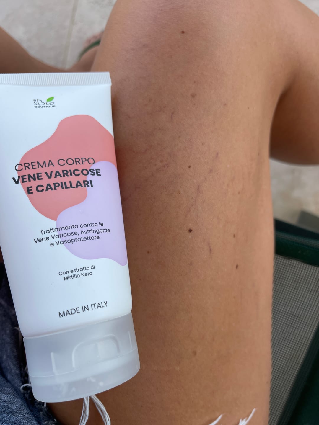 Customer photo review of Crema Vene Varicose e Capillari