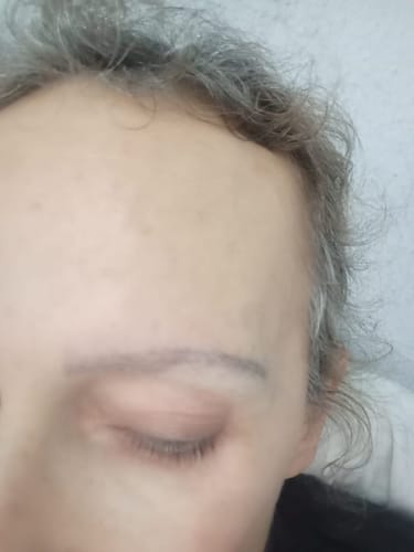 Customer photo review of Rapidlash® Eyelash Enhancing Serum