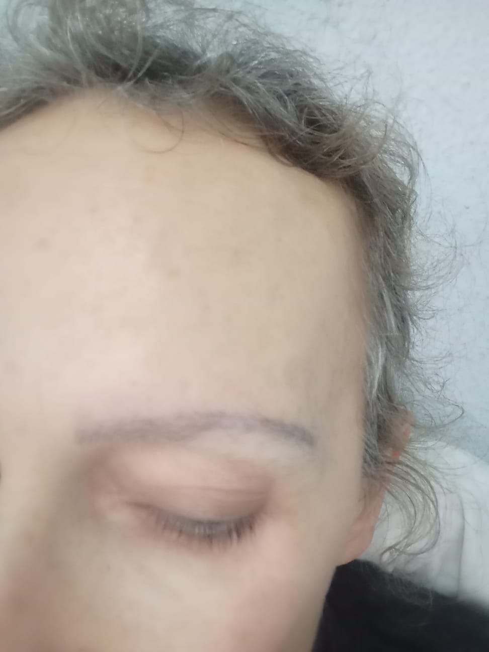 Customer photo review of Rapidlash® Eyelash Enhancing Serum