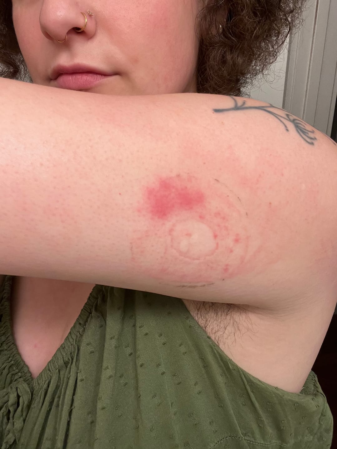 Customer photo review of Skin Grip Original - Dexcom G7 & Stelo Adhesive Patches