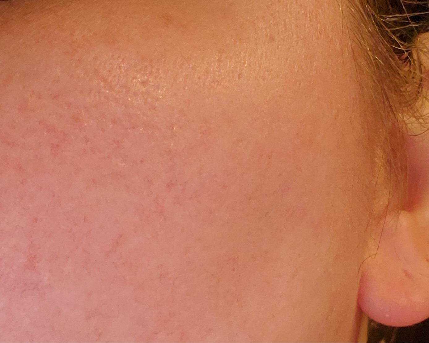 Customer photo review of Trim Pod 3.0  : The Best Dermaplaning Tool For Women Over 40