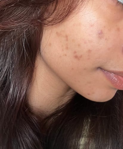 Customer photo review of Spot Doctor