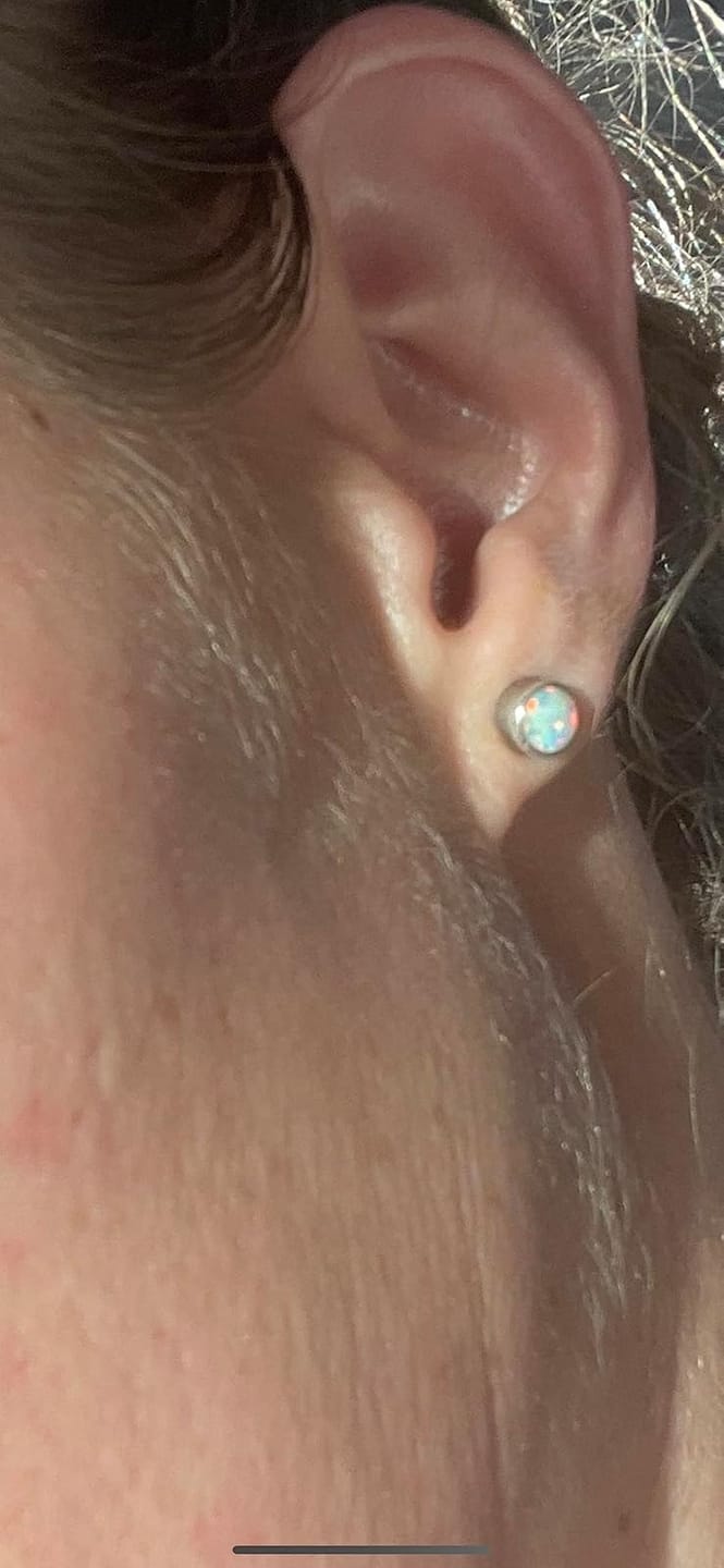 Customer photo review of Trim Pod 3.0  : The Best Dermaplaning Tool For Women Over 40
