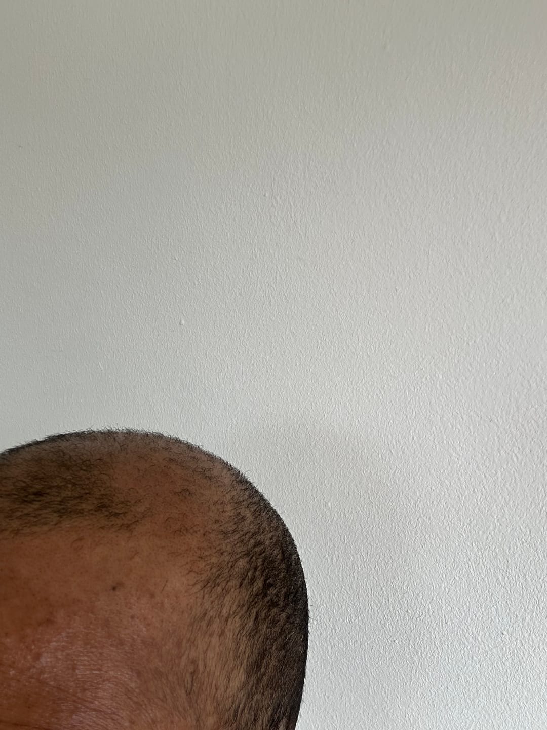 Customer photo review of Oilty - Hair Growth Oil