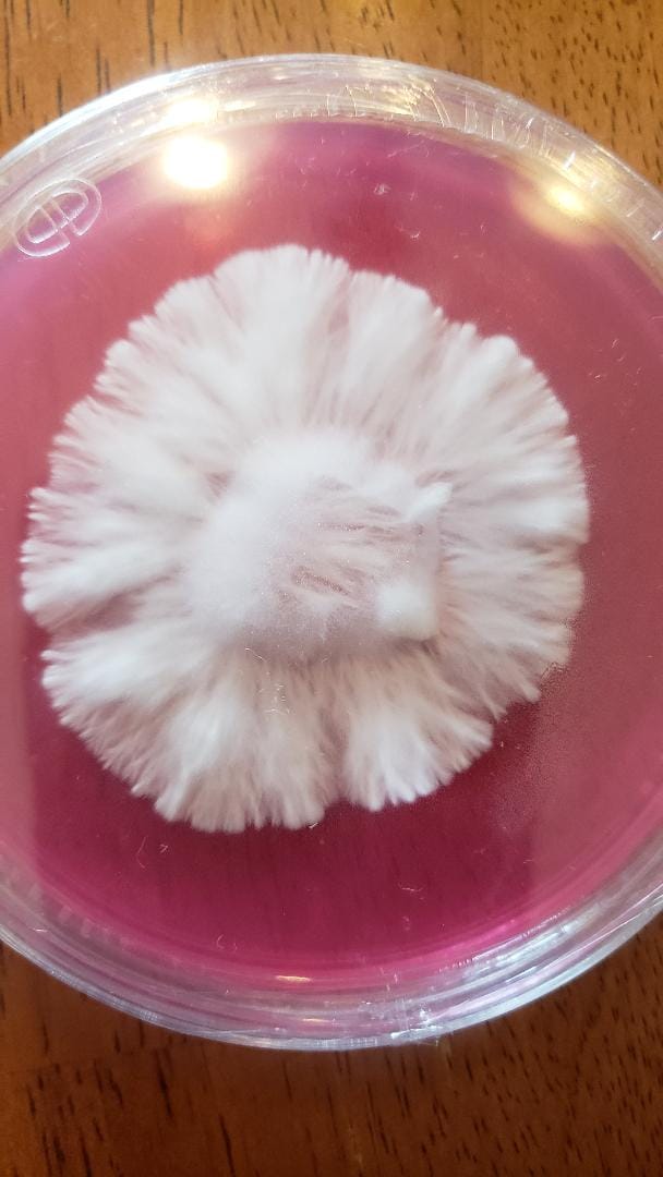 Customer photo review of Premium Sterilized Malt Extract Agar Plates - 5 Pack