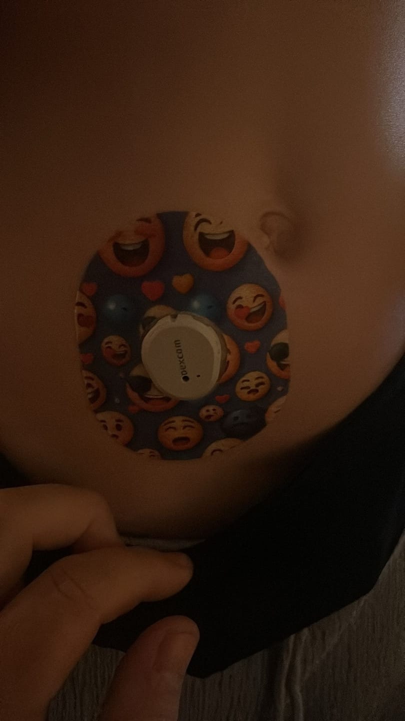 Customer photo review of Smiley Emoji CGM-Sensor overpatches för Dexcom G7