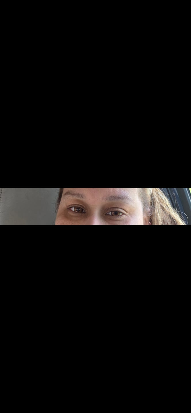 Customer photo review of Three Tone HONEY Brown Prescription Coloured Contact Lenses