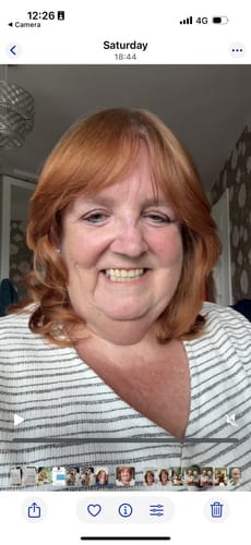 Customer photo review of 5-Step Clear Skin Kit