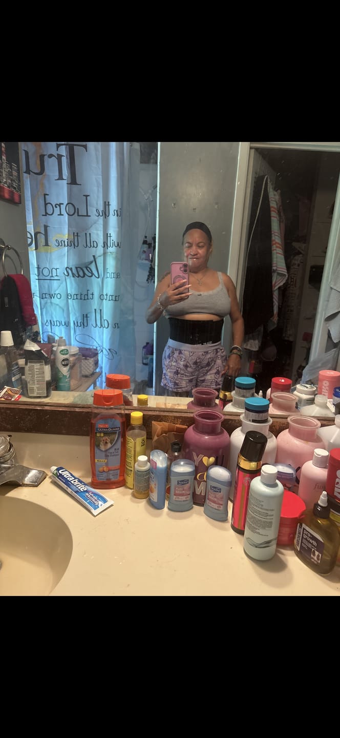 Customer photo review of (On Sale $0.01)Hourglass Girdle