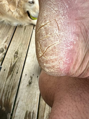 Customer photo review of F-Balm - Premium Anti-aging Tallow Balm - 2 oz.