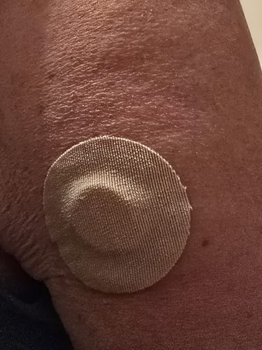 Customer photo review of Skin Grip Original - Libre 3 Adhesive Patches