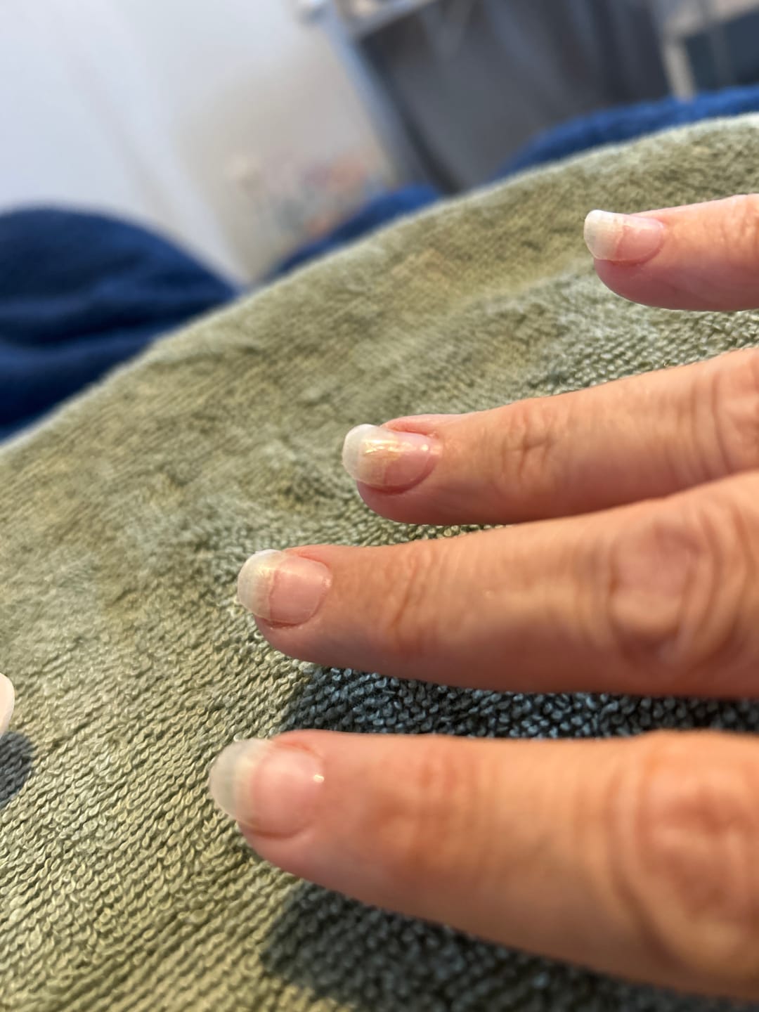 Customer photo review of Crystal Clear DIY Semicured Gel Nail Sticker Kit (STOP NAIL BITING & GROW BRITTLE NAILS)